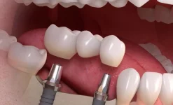 стоматологическая клиника резидент плюс изображение 6 на проекте infodoctor.ru