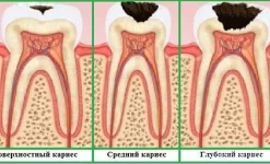 стоматологическая клиника крепкий орешек изображение 6 на проекте infodoctor.ru
