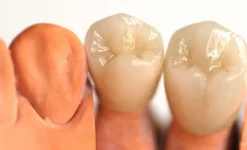 стоматологическая клиника крепкий орешек изображение 1 на проекте infodoctor.ru