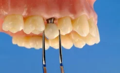 стоматологическая клиника крепкий орешек изображение 2 на проекте infodoctor.ru
